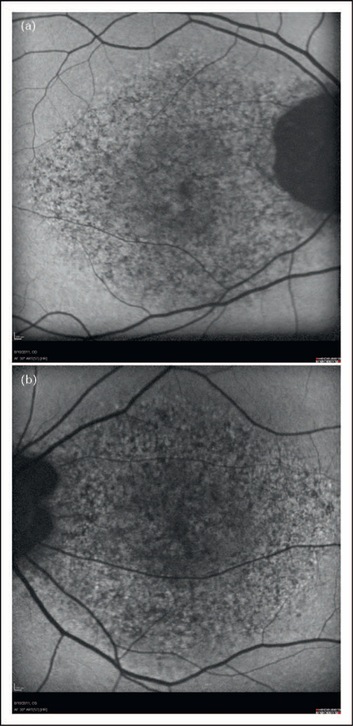 FIGURE 3