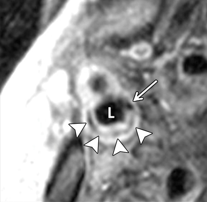 Figure 2a: