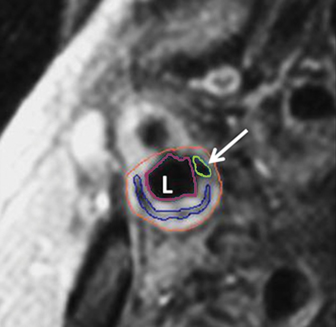 Figure 2b: