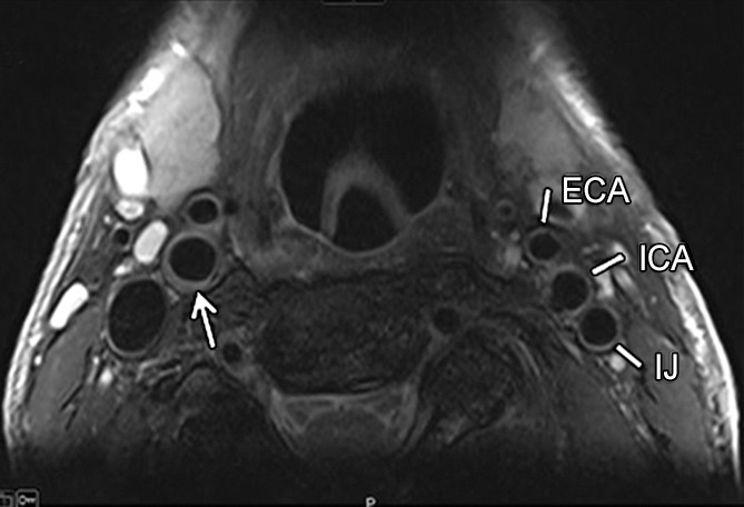 Figure 1a: