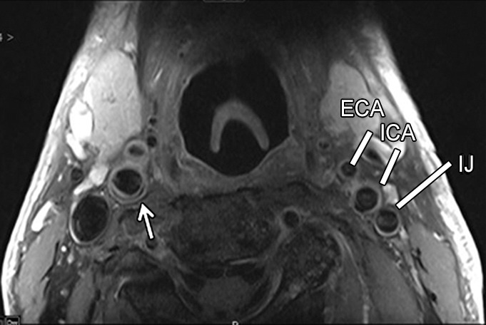 Figure 1c: