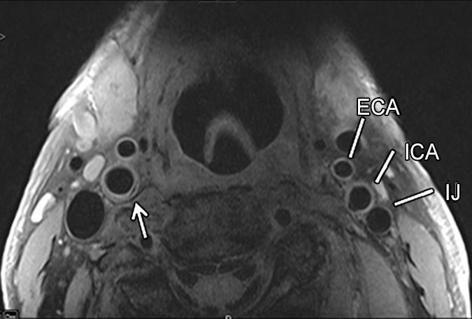 Figure 1b: