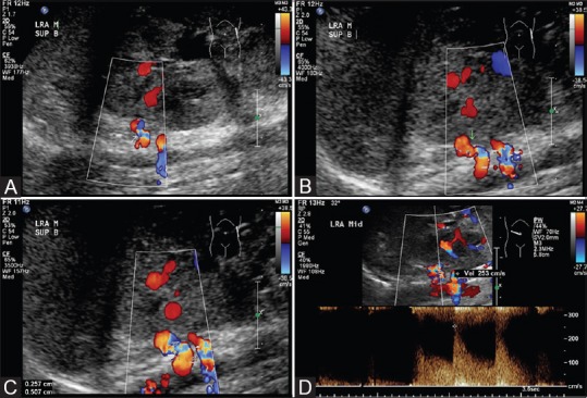 Figure 2(A-D)