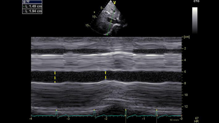 Fig. 4