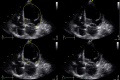 Fig. 7