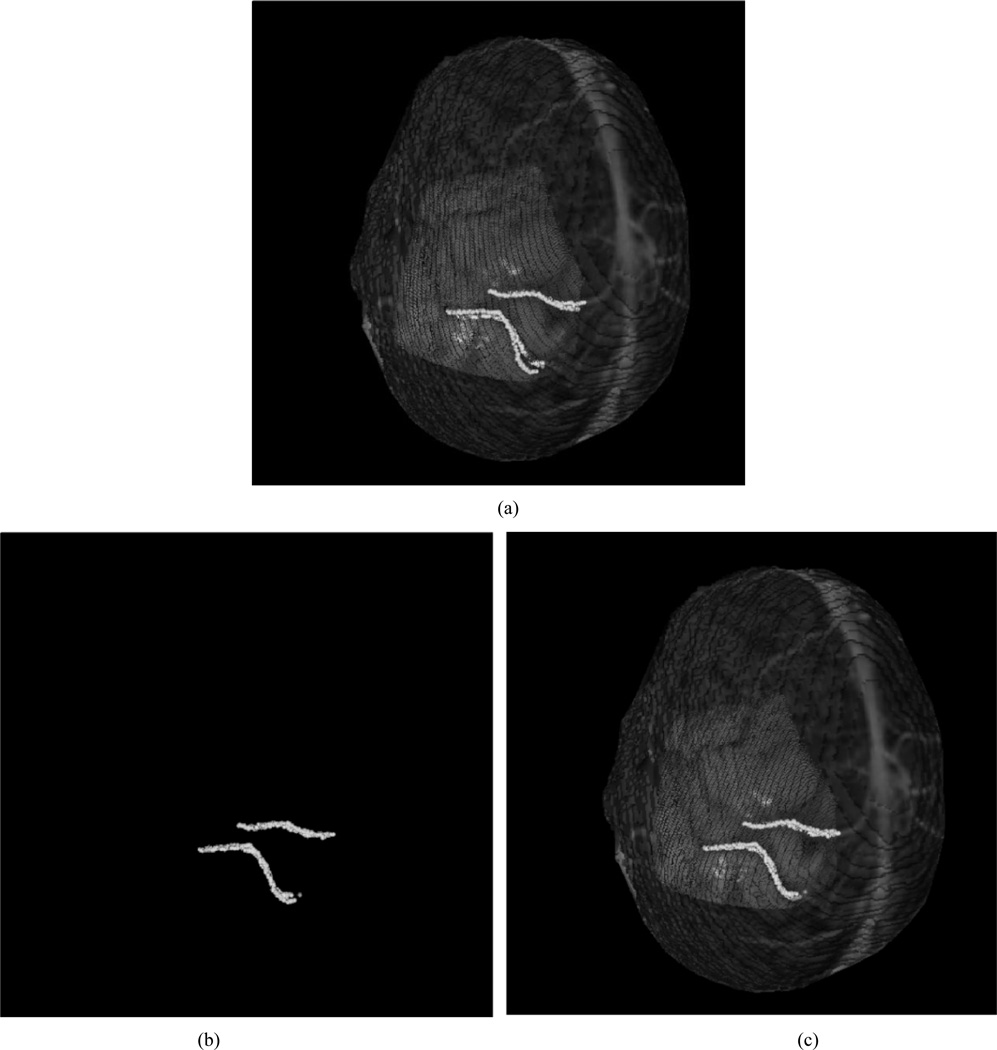 Fig. 12