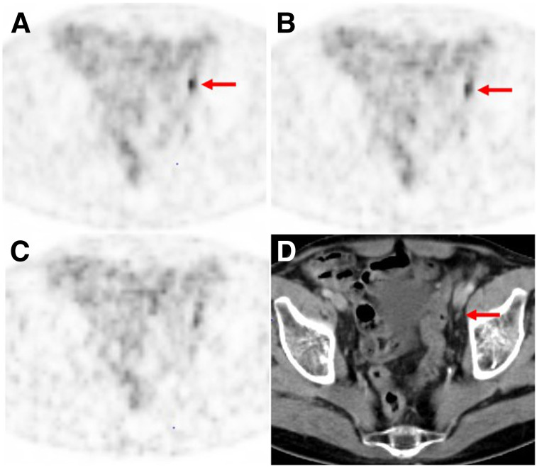 FIGURE 3.