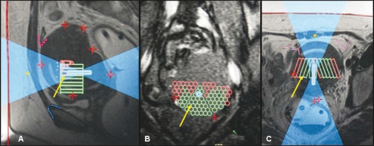 Figure 2 (A-C)