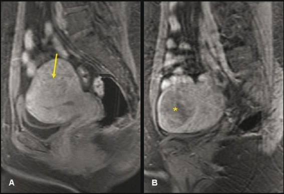 Figure 5 (A, B)