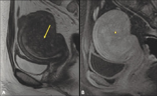 Figure 1 (A, B)