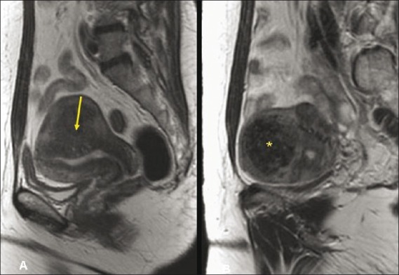 Figure 4 (A, B)