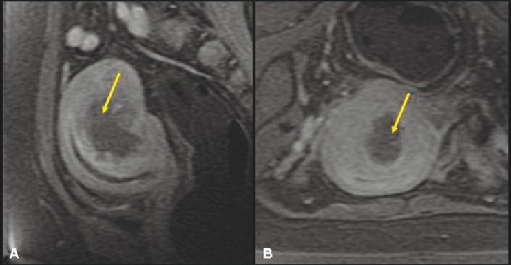 Figure 3 (A, B)