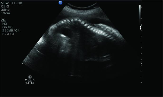 [Table/Fig-1b]: