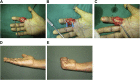 Fig. 12