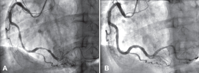 Figure 2)