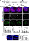 Figure 2. Zebrafish xenotransplant model of shControl and shPLCG1 CACO-2 cells treated with cetuximab. A, Human cancer cell line CACO-2 (shCtrl and shPLCG1) was fluorescently labeled with DiI (red) and injected into the perivitelline space (PVS) of 2 days postfertilization (dpf) nacre/casper zebrafish larvae. Zebrafish xenografts were treated in vivo with cetuximab for 72 hours and compared with untreated controls regarding tumor size, cell death, cell proliferation, and metastasis formation. B–E”, At 4 dpi, zebrafish xenografts were imaged on PVS and over the zebrafish body by confocal microscopy. F, Analysis of tumor size (*, P = 0.0387; **, P = 0.0063; ***, P = 0.0007). G, Analysis of activated caspase 3 (apoptosis; ****, P < 0.0001). H, Percentage of Ki-positive cells (*, P = 0.0191; **, P = 0.0021; ***, P = 0.0001; ****, P< 0.0001). I and J, Representative images of CACO-2 micrometastasis. K, Metastasis quantification (shPLCG1 versus shPLCG1 cetuximab *P = 0.0238, shCTRL versus shPLCG1 cetuximab *P = 0.0124, shCTRL cetuximab versus shPLCG1 cetuximab ***P = 0.0004). The outcomes are expressed as AVG ± SEM. Results are from two independent experiments and the number of xenografts analyzed are indicated in the representative images. Each dot represents one zebrafish xenograft. Statistical analysis was performed as described in Statistical Analysis section (ns > 0.05; *, P ≤ 0.05; **P ≤ 0.01; ***P ≤ 0.001, ****P ≤ 0.0001). Scale bars represent 50 μm. All images are anterior to the left, posterior to right, dorsal up, and ventral down.