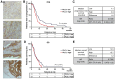 Figure 3. PLCγ1 expression in colorectal cancer tumors and its association with cetuximab responses. A, IHC analysis of PLCγ1 expression in human colorectal cancer specimens. Intensity of PLCγ1 cytoplasmic staining in tumor cells ranges from 0 (absence of staining) to 3 (maximal intensity; magnification, 200×). B–E, Kaplan–Meier curves of PFS and OS of patients with colorectal cancer expressing high and low levels of PLCγ1. Median time of survival for both analyses is shown in the picture. P value of the Kaplan–Meier curves was calculated using the log-rank test.