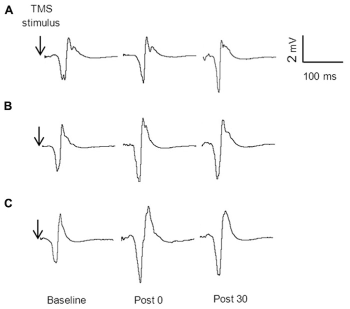 FIGURE 4