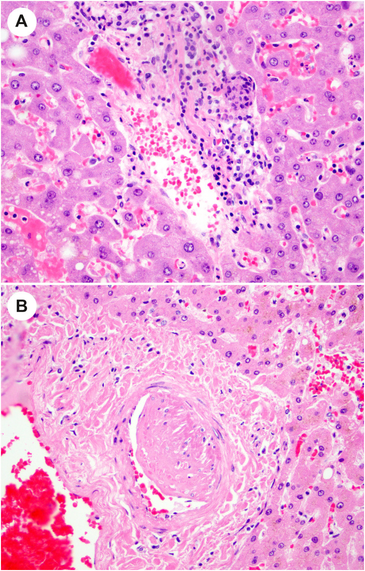 Fig. 14