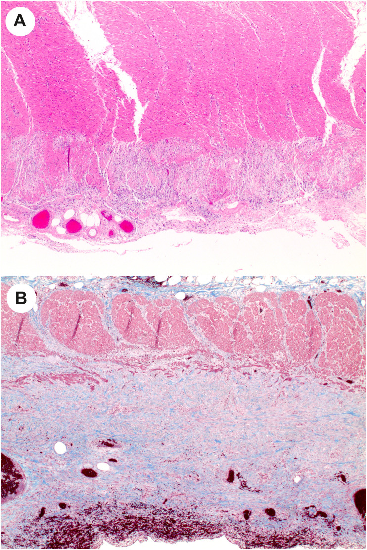 Fig. 6