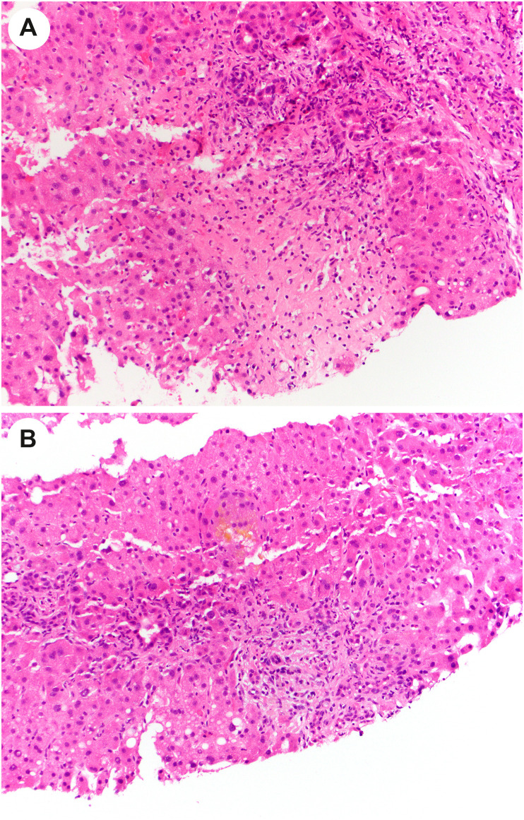 Fig. 17