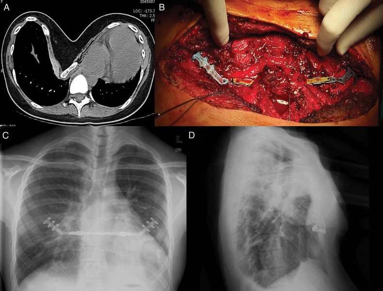 Figure 1: