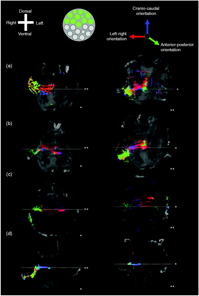 Mapping the trigeminal root entry zone and its pontine fibre ...