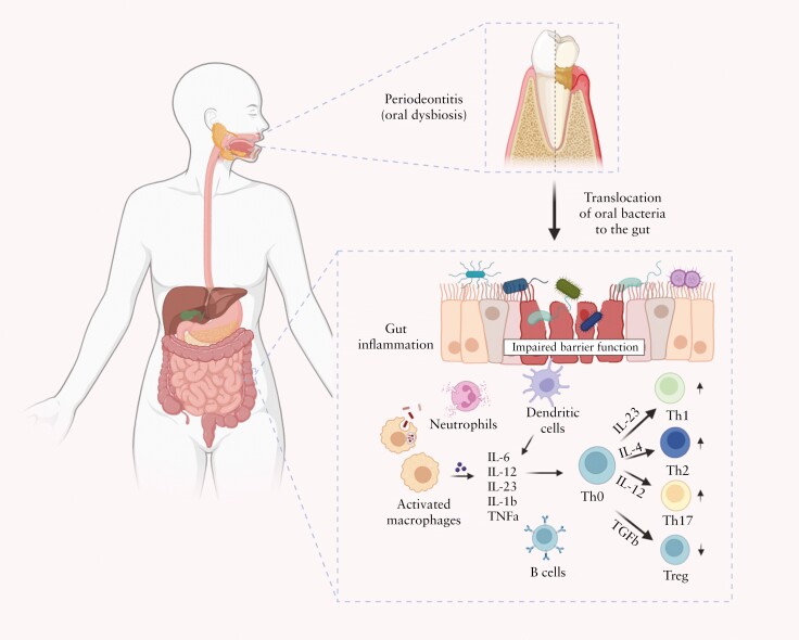 It should be Periodontitis instead of Periodeontitis in the figure.