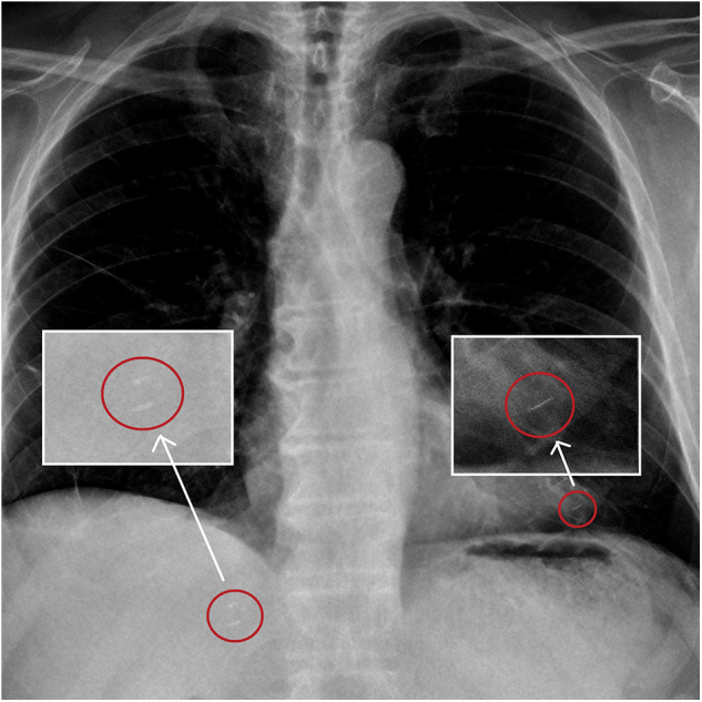 Fig 2