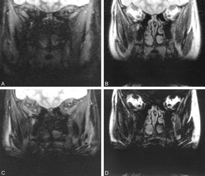 fig 2.