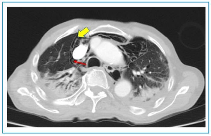 FIGURE 3: