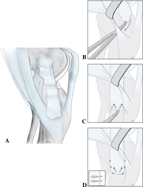 Fig. 3A–D