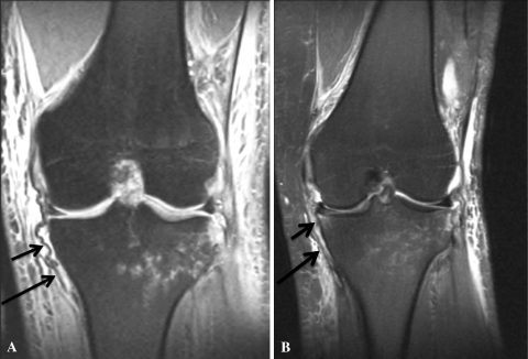 Fig. 1A–B