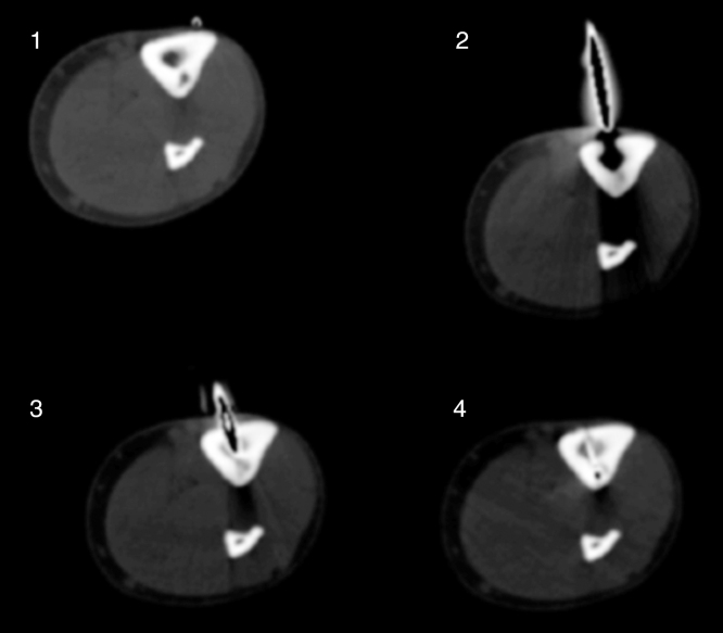 Fig. 4