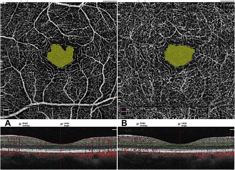 Fig. 1