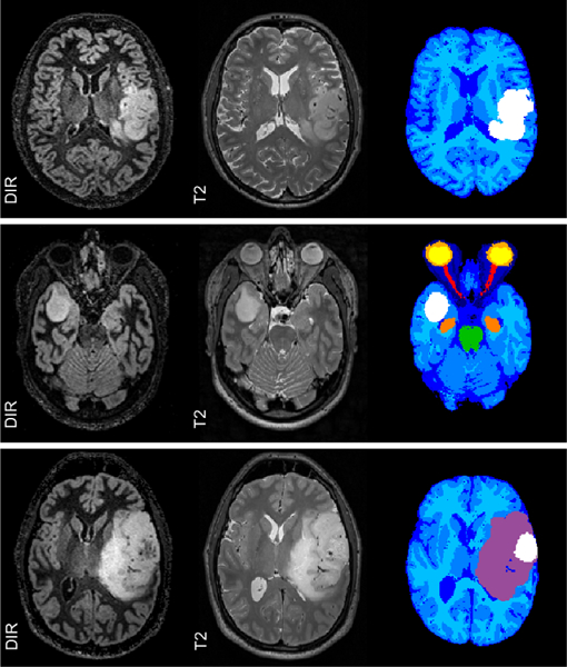 Figure 14: