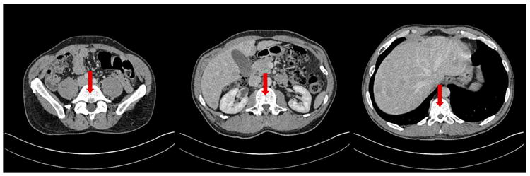 Fig. 10