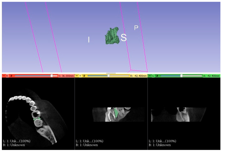 Figure 5