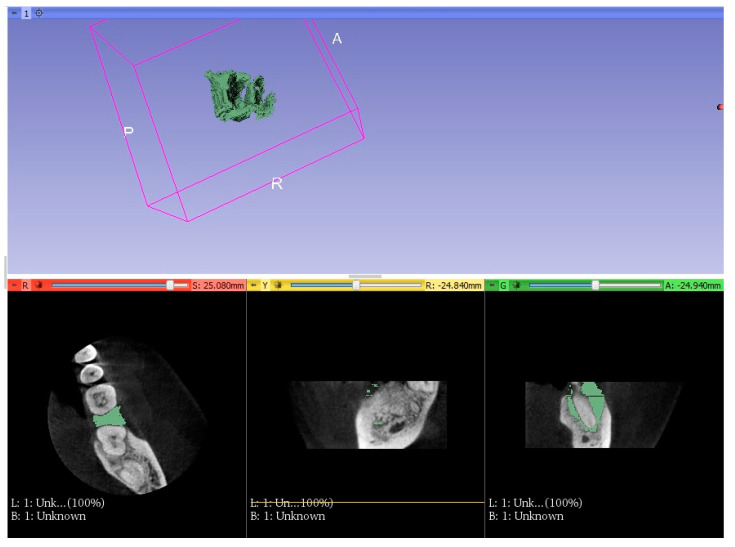 Figure 4