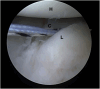 Fig 14