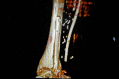 Fig. 12.