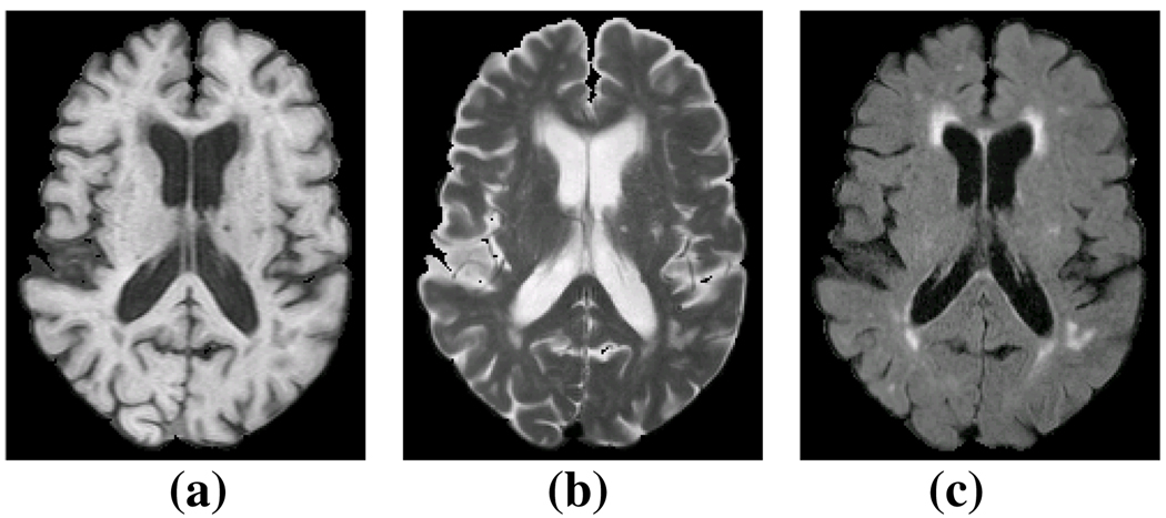 Fig. 1