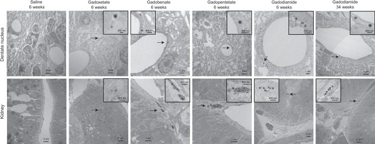 Tissue localization of gadolinium deposits. Cellular localization of gadolinium deposits (arrows) using transmission electron microscopy are shown for dentate nuclei (top row) and kidney (bottom row) tissues of control and gadolinium-based contrast agent–exposed rats harvested at indicated postinjection time points.