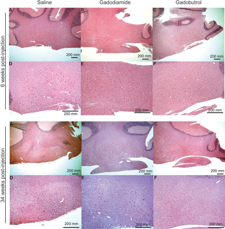 Histopathologic analysis. Representative light microscopy images of the dentate nucleus are shown for (A, D) saline (control), (B, E) gadodiamide, and (C, F) gadobutrol-exposed animals at 6 and 34 weeks after injection. (Originial magnification, ×40 in AEN_DASHC and ×100 in DEN_DASHF; hematoxylin-eosin stain.)