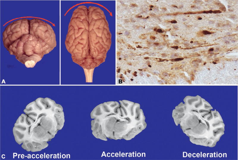 Fig. 8.5