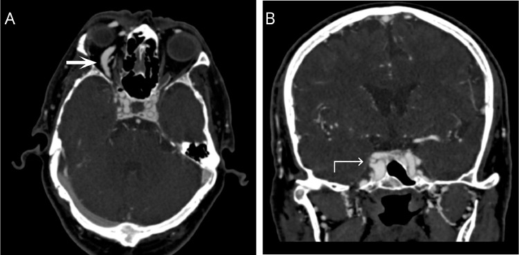 Fig. 1. –