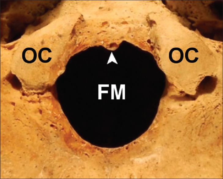 Figure 21