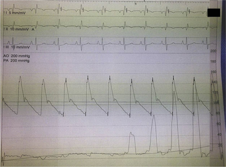 Fig. 1