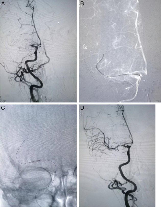 FIGURE 1