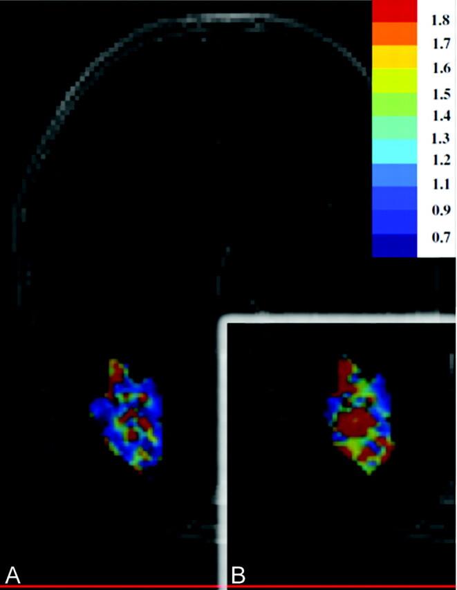 Fig 6.